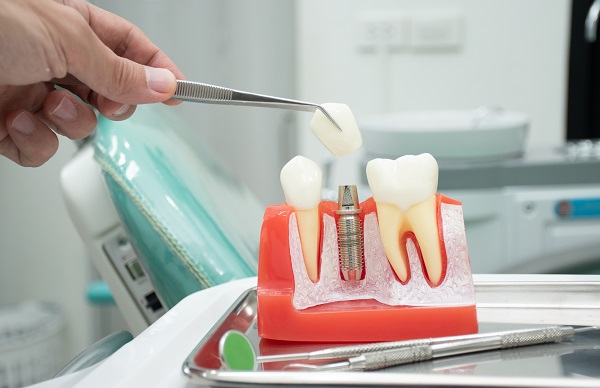 Three Tips For Choosing The Right Dentist For Periodontics Treatment